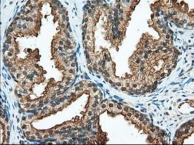 Immunohistochemistry: RanGAP1 Antibody (OTI1B4) - Azide and BSA Free [NBP2-73797]