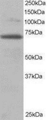 Western Blot: RanGAP1 Antibody [NB100-1384]