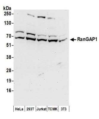 Western Blot: RanGAP1 Antibody [NBP1-18915]