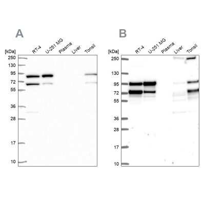 Western Blot: RanGAP1 Antibody [NBP2-33591]