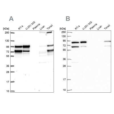 Western Blot: RanGAP1 Antibody [NBP2-56215]