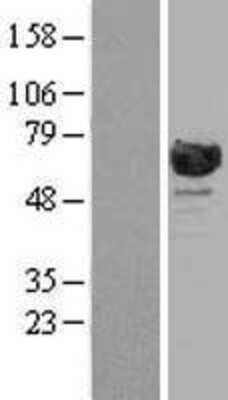Western Blot: RanGAP1 Overexpression Lysate [NBL1-15144]
