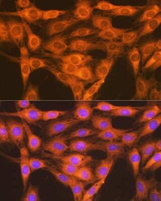Immunocytochemistry/ Immunofluorescence: Rap1A/B Antibody (6C7G0) [NBP3-16868]