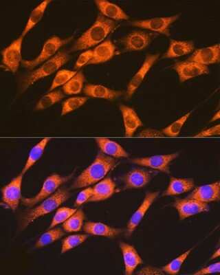 Immunocytochemistry/ Immunofluorescence: Rap1A/B Antibody (6C7G0) [NBP3-16868]