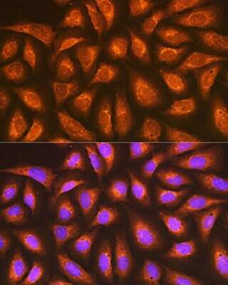 Immunocytochemistry/ Immunofluorescence: Rap1A/B Antibody (6C7G0) [NBP3-16868]