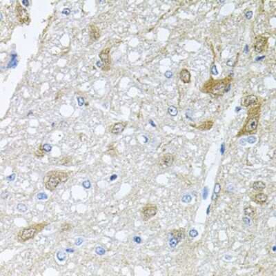 Immunohistochemistry-Paraffin: Rapsyn Antibody - BSA Free [NBP2-94107]