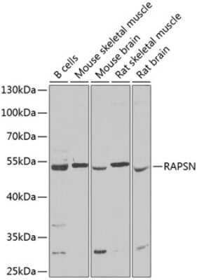 Western Blot: Rapsyn AntibodyBSA Free [NBP2-94107]
