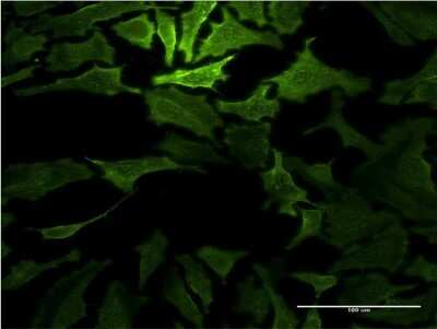 Immunocytochemistry/ Immunofluorescence: Ras-GAP Antibody (3D4) [H00005921-M04]