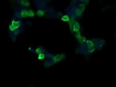 Immunocytochemistry/ Immunofluorescence: Ras-GAP Antibody (OTI1H2) - Azide and BSA Free [NBP2-73804]