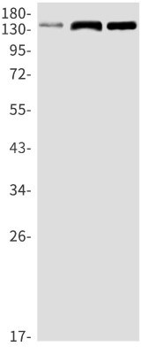 Western Blot: Ras-GAP Antibody (S01-1D7) [NBP3-20000]
