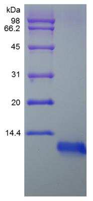 SDS-PAGE: Recombinant Rat IGF-I/IGF-1 Protein [NBP2-35219]