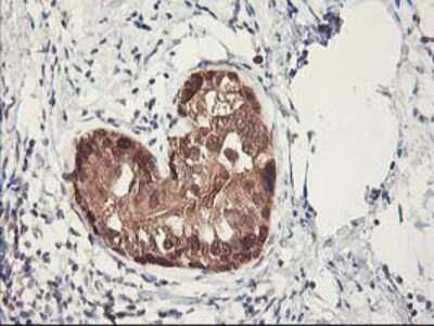 Immunohistochemistry-Paraffin: RbAp46 Antibody (OTI5A4) [NBP2-01308]