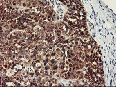 Immunohistochemistry-Paraffin: RbAp46 Antibody (OTI5A4) [NBP2-01308]
