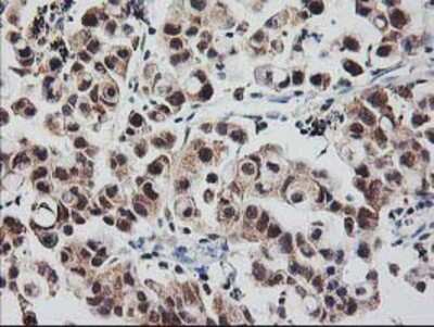 Immunohistochemistry-Paraffin: RbAp46 Antibody (OTI5A4) [NBP2-01308]