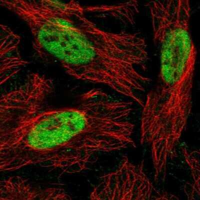 Immunocytochemistry/ Immunofluorescence: RBBP4/RbAp48 Antibody [NBP2-46858]