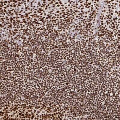 Immunohistochemistry-Paraffin: RBBP4/RbAp48 Antibody [NBP2-46858]