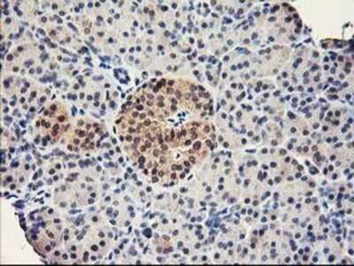 Immunohistochemistry: RbAp46 Antibody (OTI5A4) - Azide and BSA Free [NBP2-73822]