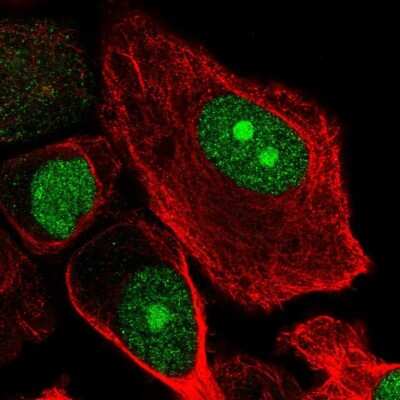 Immunocytochemistry/ Immunofluorescence: RbBP5 Antibody [NBP2-55085]
