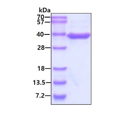 SDS-PAGE: Recombinant Human ASPA Protein [NBP2-52289]