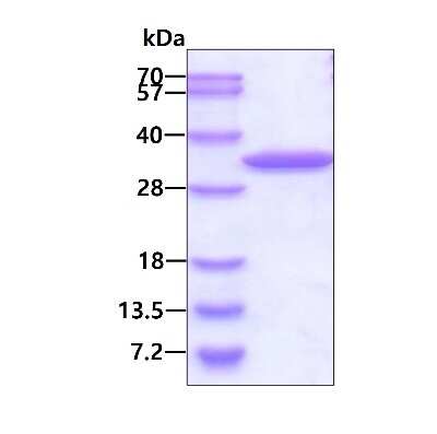 SDS-PAGE: Recombinant Human AUH His Protein [NBP1-50922]
