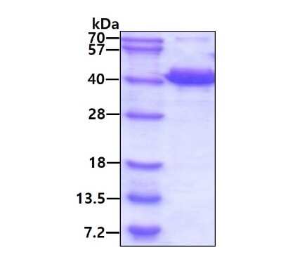 SDS-PAGE: Recombinant Human EB2 His Protein [NBP1-72455]