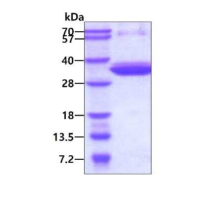 SDS-PAGE: Recombinant Human IGHG1 Protein [NBP3-18523]