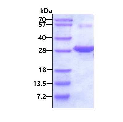 SDS-PAGE: Recombinant Human PNPO His Protein [NBP1-50887]