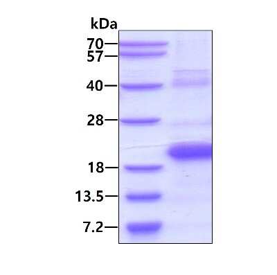 SDS-PAGE: Recombinant Human TR2IT1 His Protein [NBP2-22861]