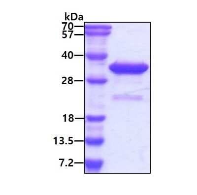 SDS-PAGE: Recombinant Human VPS24 His Protein [NBP1-72349]