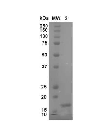 SDS-PAGE: Recombinant Human beta-Synuclein Active, Monomer Protein [NBP3-14775]