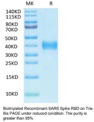 SDS-PAGE: Recombinant SARS-CoV Spike RBD Biotin His Avi-tag Protein [NBP3-07948]