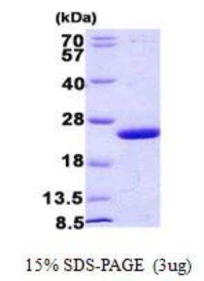 SDS-PAGE: Recombinant E. coli Double-Stranded Uracil-DNA Glycosylase His Protein [NBP2-75954]