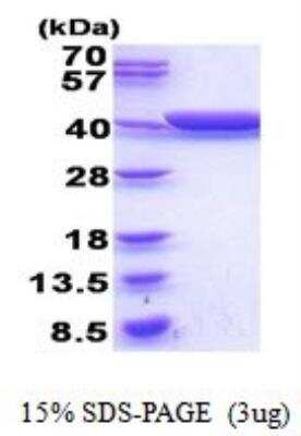 SDS-PAGE: Recombinant E. coli Glycerol dehydrogenase His Protein [NBP2-52133]