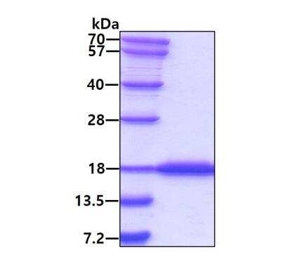 SDS-PAGE: Recombinant E. coli Nucleoside Diphosphate Kinase His Protein [NBP2-75953]
