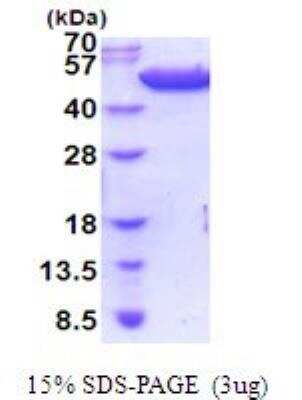 SDS-PAGE: Recombinant E. coli Tryptophanase His Protein [NBP2-51970]