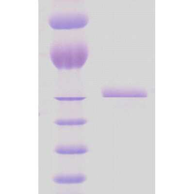 SDS-PAGE: Recombinant HSP65 (mycobacterial) Protein [NBP3-09170]