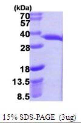 SDS-PAGE: Recombinant E. coli Chaperone protein hchA His Protein [NBP1-78802]