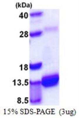 SDS-PAGE: Recombinant Mouse S100A4 His Protein [NBP1-72326]