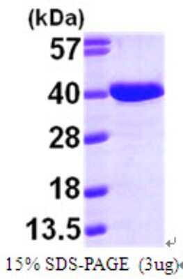 SDS-PAGE: Recombinant Human AASD-PPT His Protein [NBP1-49307]
