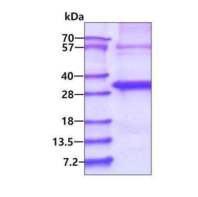 SDS-PAGE: Recombinant Human ABHD12B His Protein [NBP2-51741]