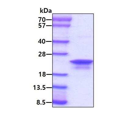 SDS-PAGE: Recombinant Human AG-2/AGR2 His Protein [NBC1-18502]