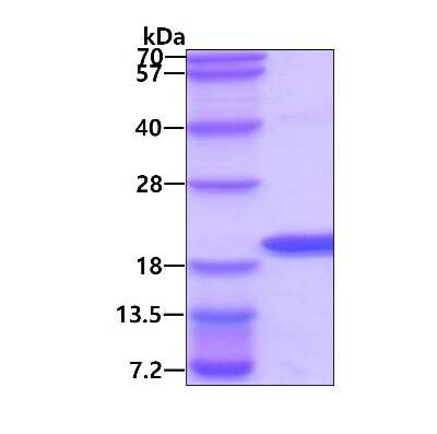 SDS-PAGE: Recombinant Human AG-3/AGR3 His Protein [NBP1-72342]