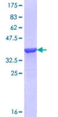 SDS-PAGE: Recombinant Human AGXT GST (N-Term) Protein [H00000189-Q01]