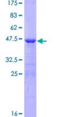 SDS-PAGE: Recombinant Human AHNAK GST (N-Term) Protein [H00079026-P01]