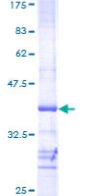 SDS-PAGE: Recombinant Human AKT2 GST (N-Term) Protein [H00000208-Q01]