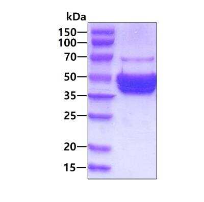 SDS-PAGE: Recombinant Human AKT3 His Protein [NBP3-13999]
