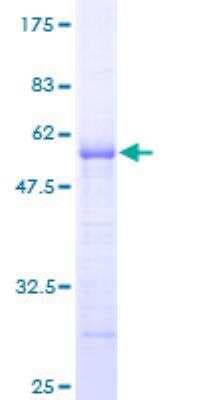 SDS-PAGE: Recombinant Human ARHGDIG GST (N-Term) Protein [H00000398-P01]
