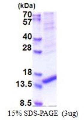 SDS-PAGE: Recombinant Human ARMS2 His Protein [NBP2-22680]