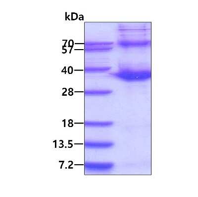 SDS-PAGE: Recombinant Human ATF1 His Protein [NBP1-78873]