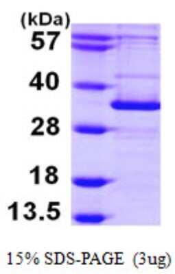 SDS-PAGE: Recombinant Human ATG5 His Protein [NBP1-50982]